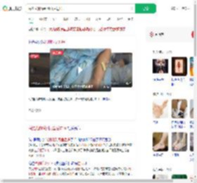 海滩光脚踩到死鱼后进ICU_360搜索