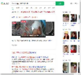 学生打球遭同学袭击致脑出血_360搜索